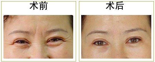 u=1504461922,2954559882&fm=27&gp=0