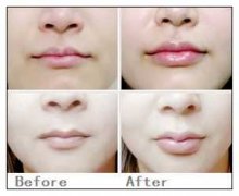 �����S������Щ�������g(sh��)ǰ��(zh��n)�乤������Щ��