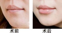 �����S���g(sh��)�������c(di��n)����Щ���g(sh��)ǰ�g(sh��)���o(h��)����Щ��