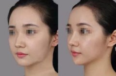 �����沿�������X��