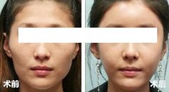 �����沿���M����,���w������ʲô�أ�