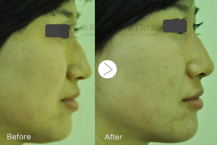 ���^���ί�ǰ��