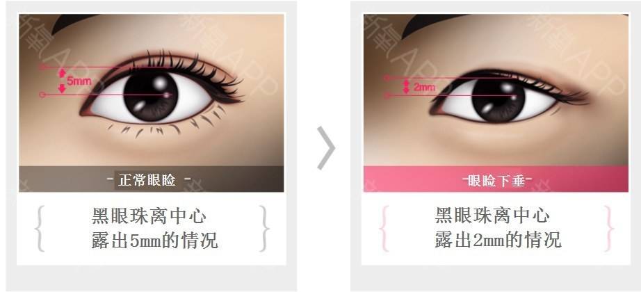 ee093ba4b5b7e4545254d09009a30f38