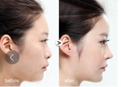 ���А�ؐܽע��¡�Ƕ����X��