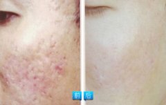 �����ӡ������ȫ����Щ��