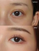 ���м�������������Ȧ��