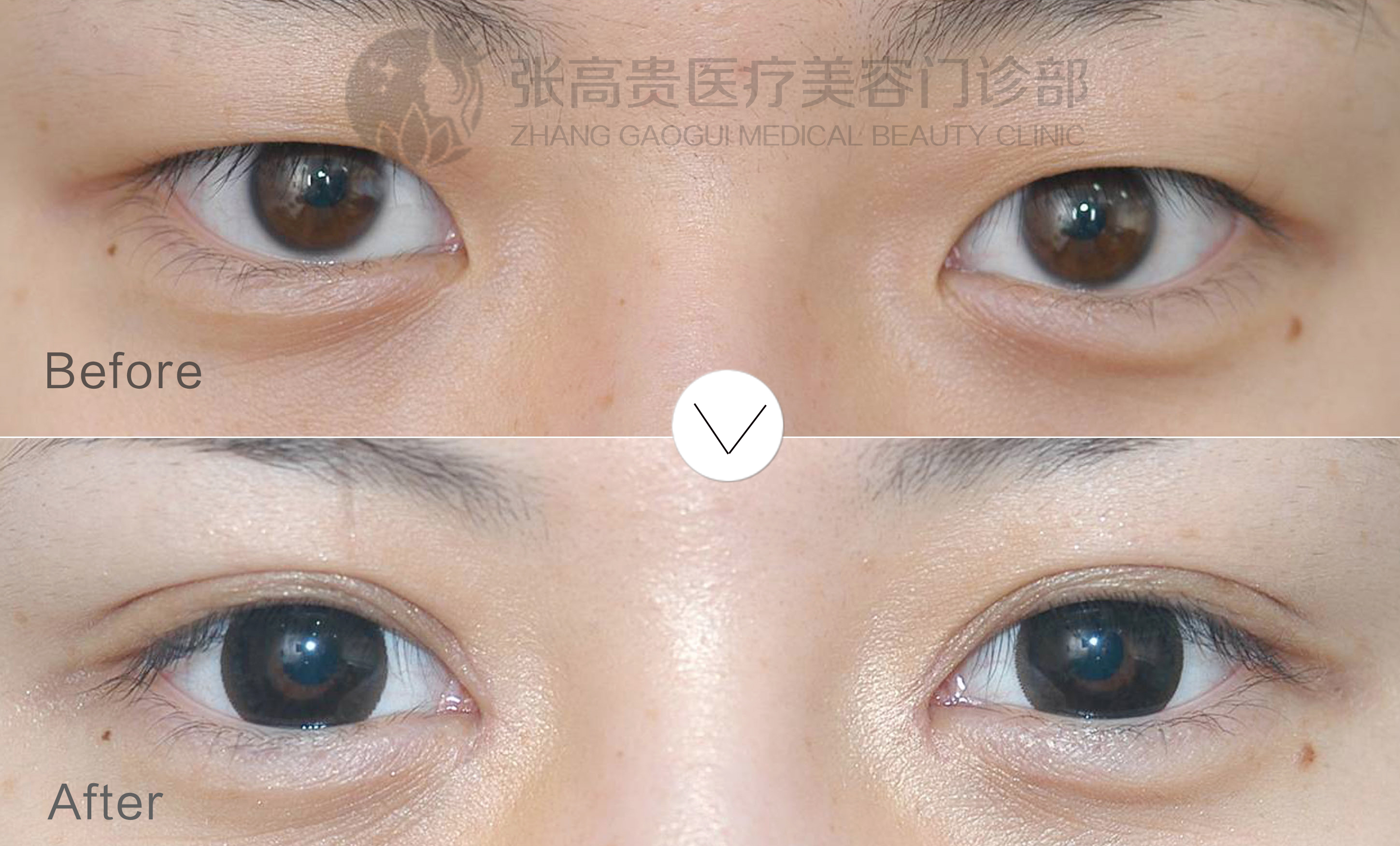 �p��Ƥ�_�۽�