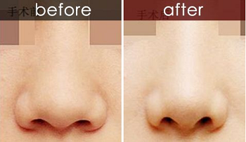 u=1126778226,4072925573&fm=26&gp=0