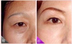 ���ͺ�������ü�g(sh��)����Щ���������x����