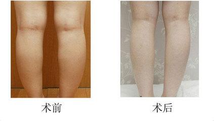 ���������t(y��)Ժ