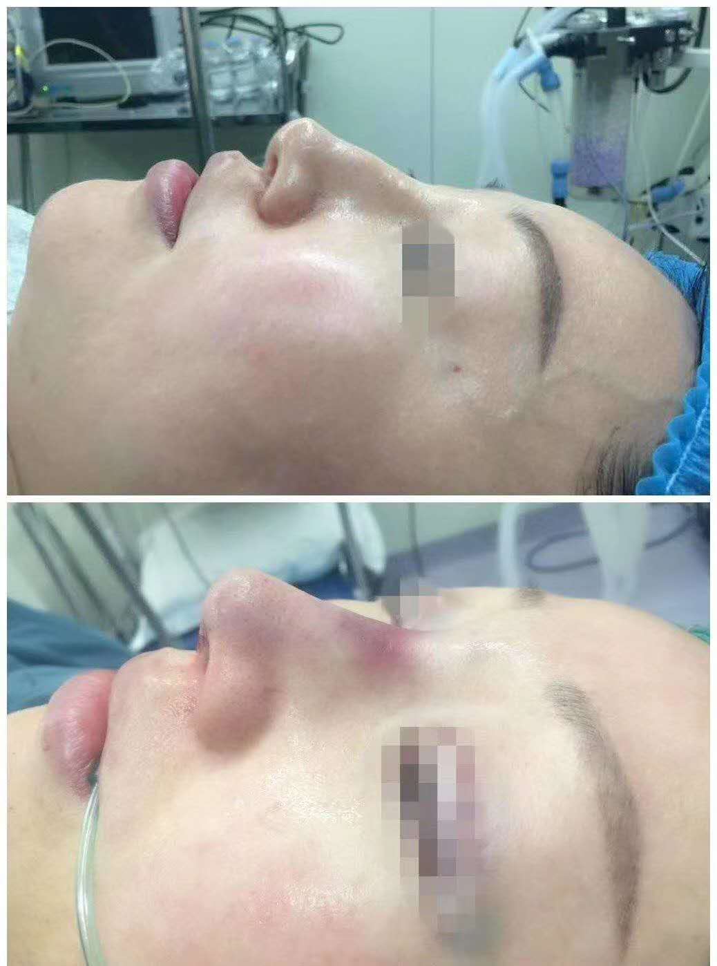 ����¡��