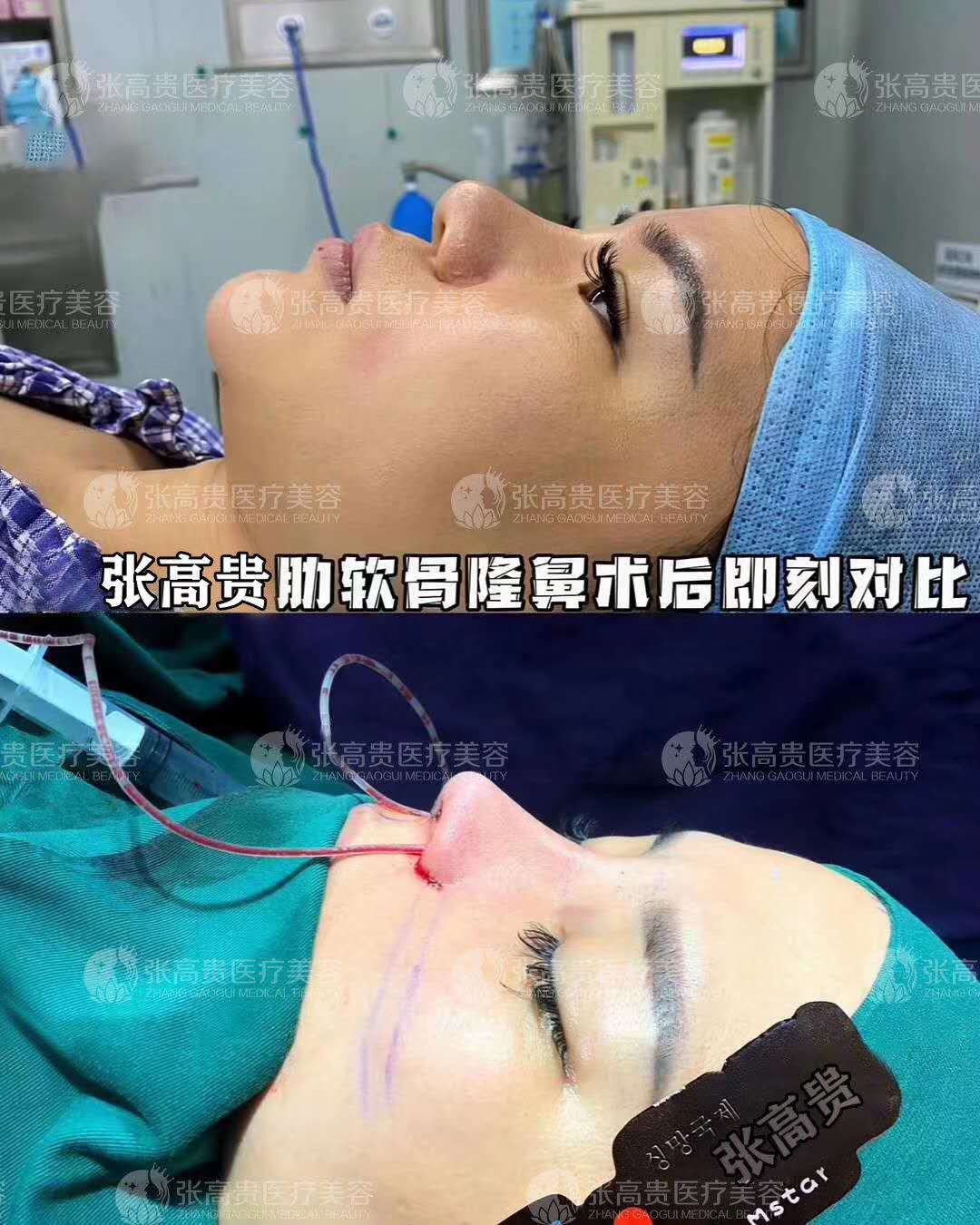 ����¡��