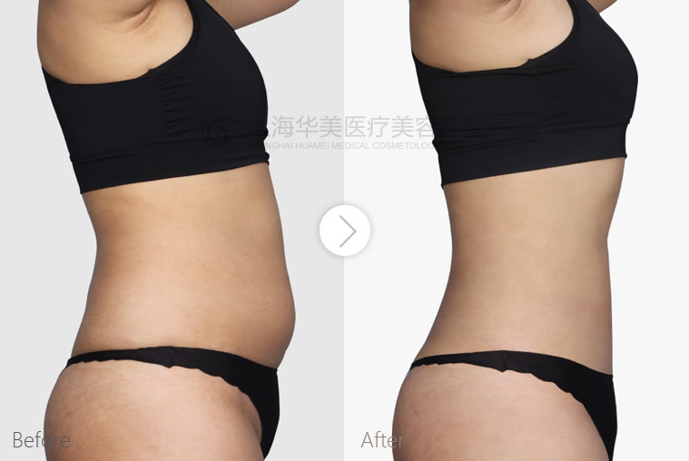 ΢�ňDƬ_20200420093256