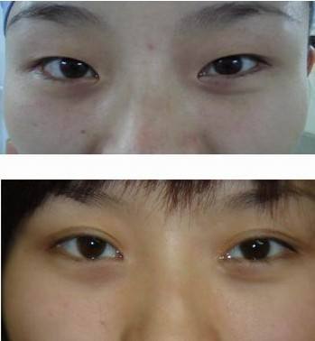 ���������t(y��)Ժ�p��Ƥ