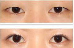 ע�䲣������Ҫע��ʲô�أ�