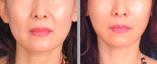 ���������t(y��)Ժע����Ę