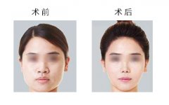 ��Ę�ķ�ʽ��������Щ��