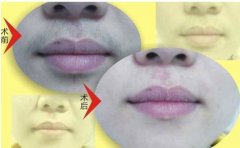 ���ͺ���Ó��ë�ܾS�ֶ������