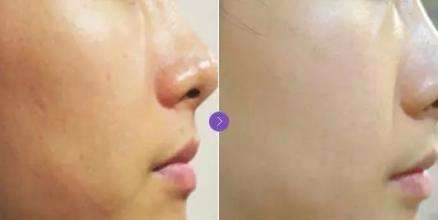 ���������t(y��)Ժ ˮ���