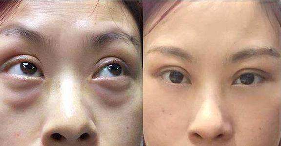 ���������t(y��)Ժ���۴�