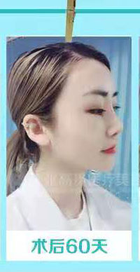 ����¡��