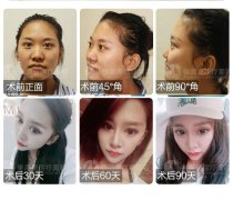  ��߀��ע�����g�o(h��)�w����������������һ��