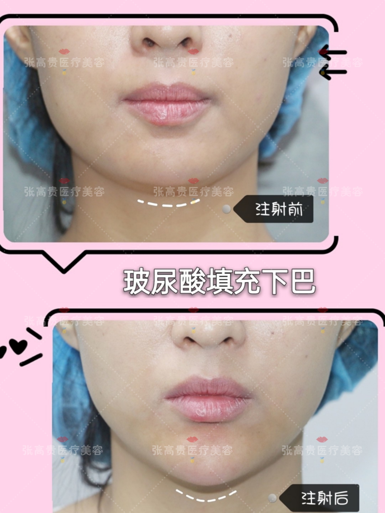 �������S�°�