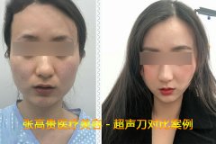 ������һ���ܾS�ֶ���������һ�β���������������t(y��)Ժ