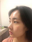 ���ͺ��������w֬���S̫�Ѩ�r���F��