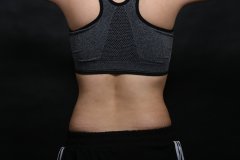 ��֬���ɵ�Ƥ��ô�k���Ƥ�w�վo